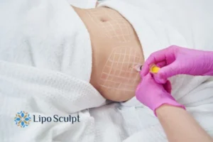 Are The Results From Aqualyx Permanent? 1 Do you want to know how long Aqualyx Berkshire results last?